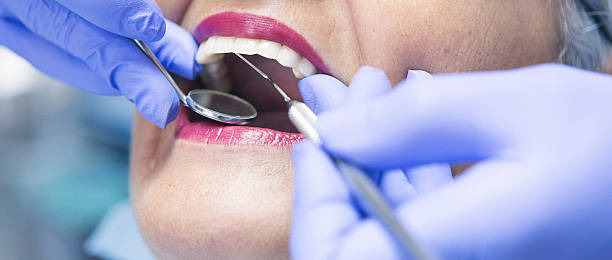 Best Emergency Dental Care for Broken or Chipped Teeth in Whitehall, WI