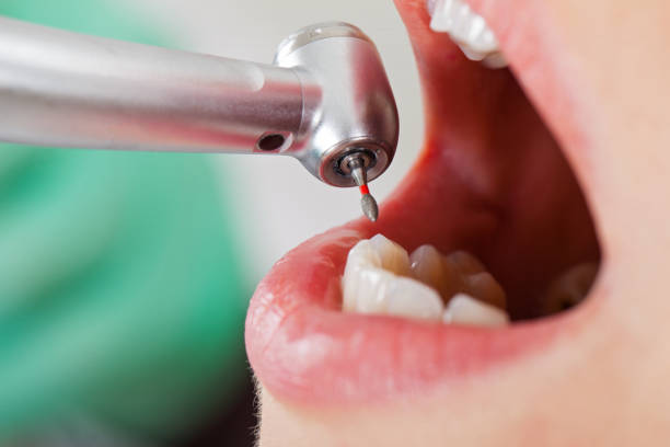 Best Emergency Treatment for Dental Infections or Abscesses in Whitehall, WI